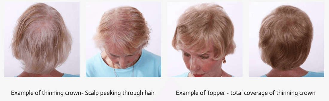 Invisible Hairpieces | Custom Color-Matched Hair Addition | Image Maker Wigs - Image Maker Wigs Online
