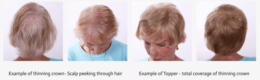 Invisible Hairpieces | Custom Color-Matched Hair Addition | Image Maker Wigs - Image Maker Wigs Online
