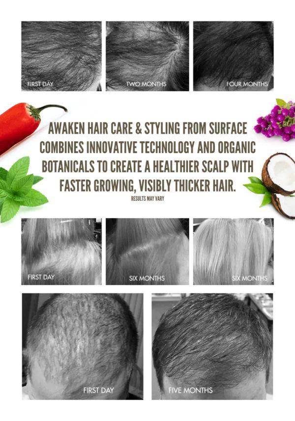 SURFACE Awaken Therapeutic Shampoo - Image Maker Wigs Online
